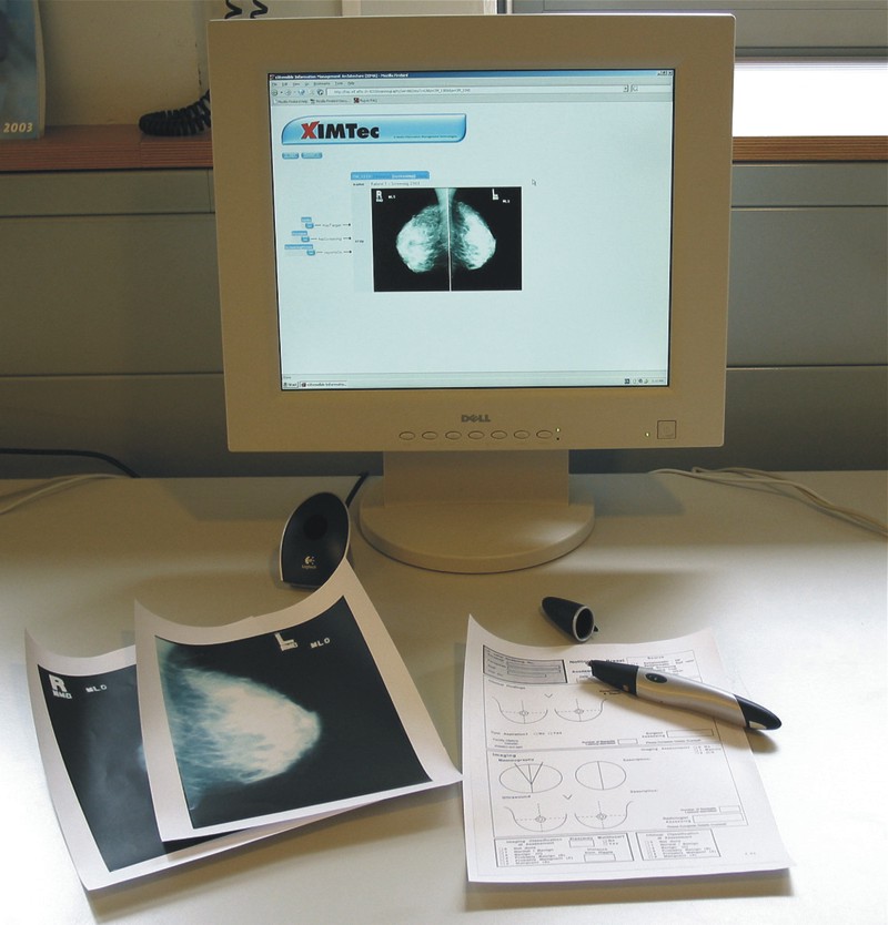 Mammography reading workplace